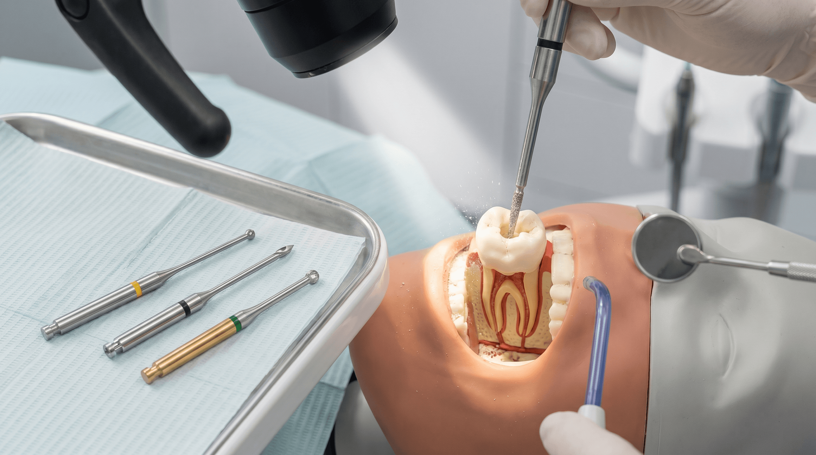 Endodontie : créer l'accès et préparer le canal