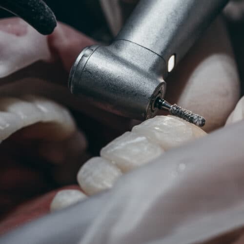 Diamant Instrumente